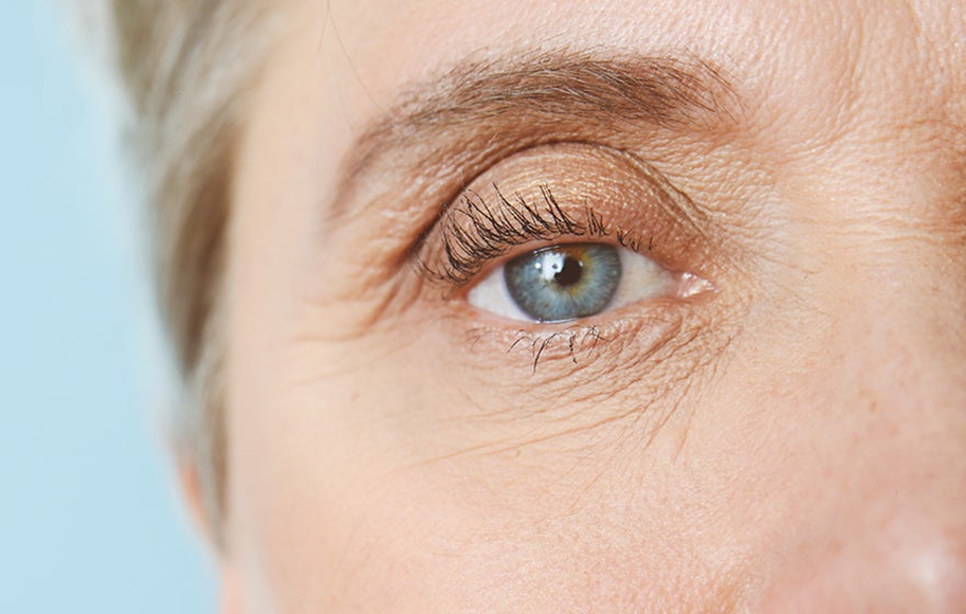 rugas nos olhos