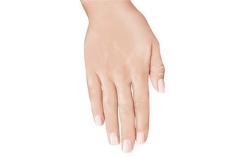 Áreas de tratamento de Sculptra mãos