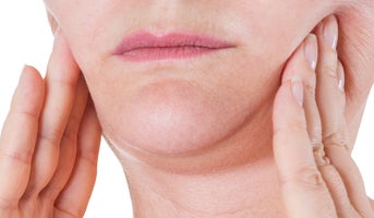 Sculptra treatment