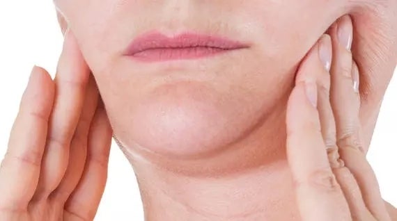 Por que Sculptra?